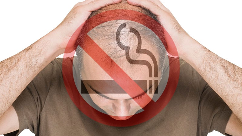 تاثیر سیگار بر ریزش موهای جلوی سر چگونه است